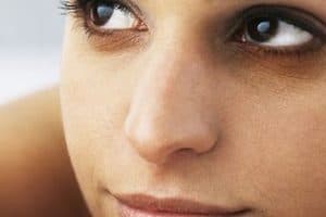 What Is Under-Eye Dark Circle Treatment?