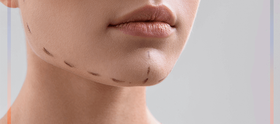 Chin Filler