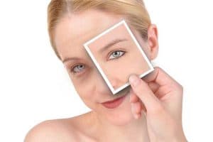 Under-Eye Mesotherapy