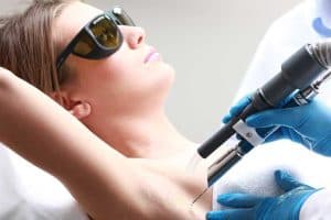 Laser Hair Removal