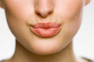 Lines Above the Lip