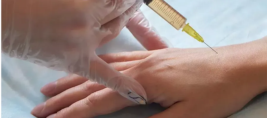 Botox for Hyperhidrosis (Excessive Sweating)