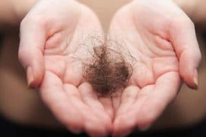 Hair Loss