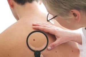 Moles & Mole Tracking
