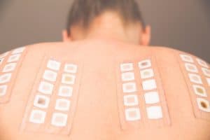 Skin Patch Test (Eczema Test)